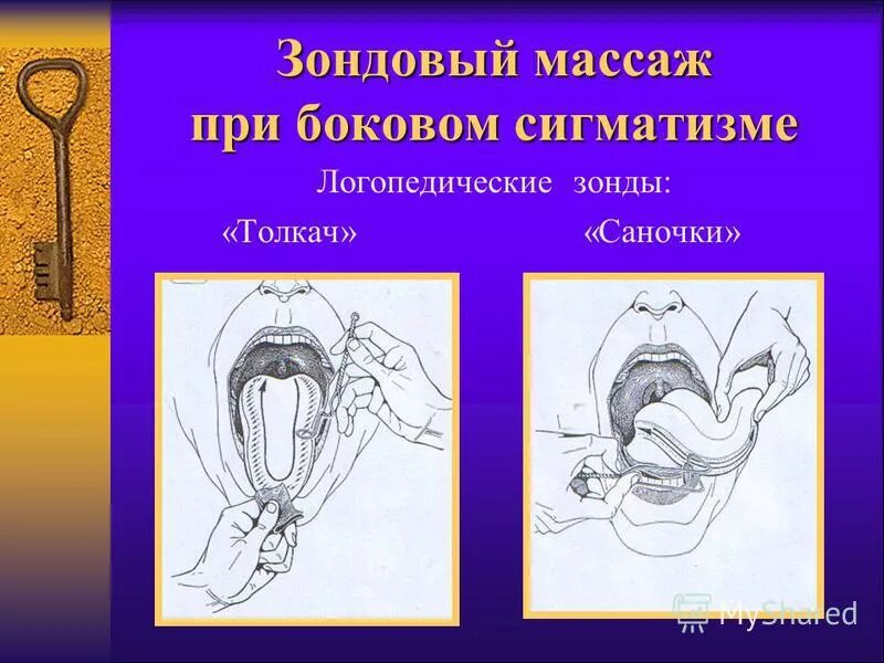 логомассаж ложкой крупенчук. самомассаж мышц языка для детей. логопедический массаж при гипертонусе языка. постановка звуков массажем. логопедический самомассаж ложками крупенчук.
