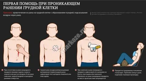 Проникающее ножевое ранение грудной клетки