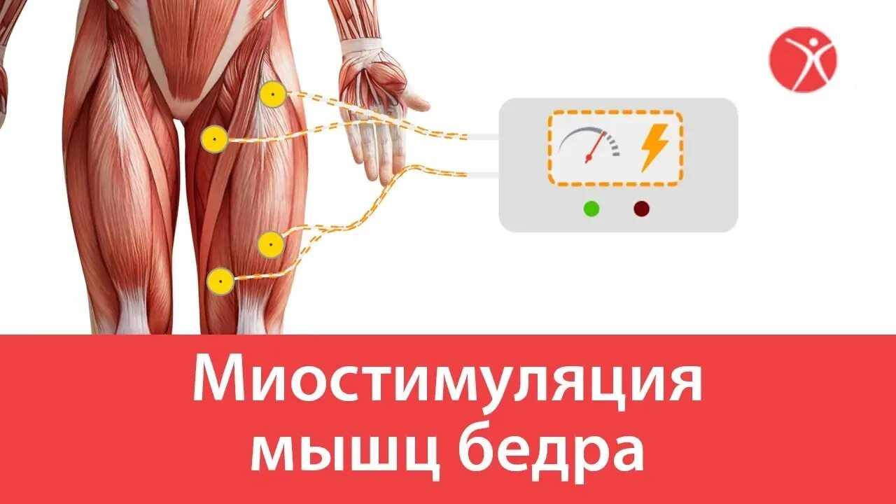 Стимуляция мышц. Стимуляция мышц. Стимуляция мышц. Электростимуляция мышц нижних конечностей. Электростимуляция четырехглавой мышцы.