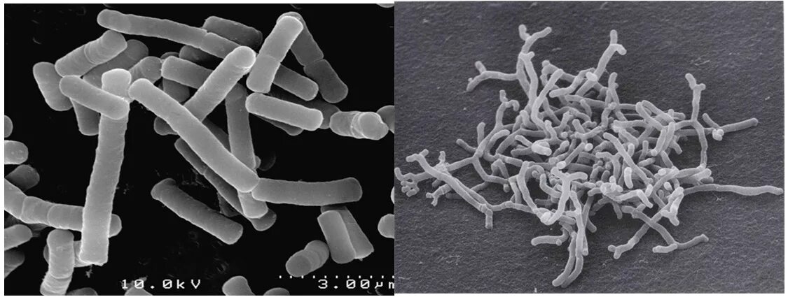 Палочка бифидобактерии. Бактерии Bifidobacterium longum. Микроскопия бифидобактерии бифидум. Кисломолочные бактерии лактобацилус. Lactobacillus и Bifidobacterium.