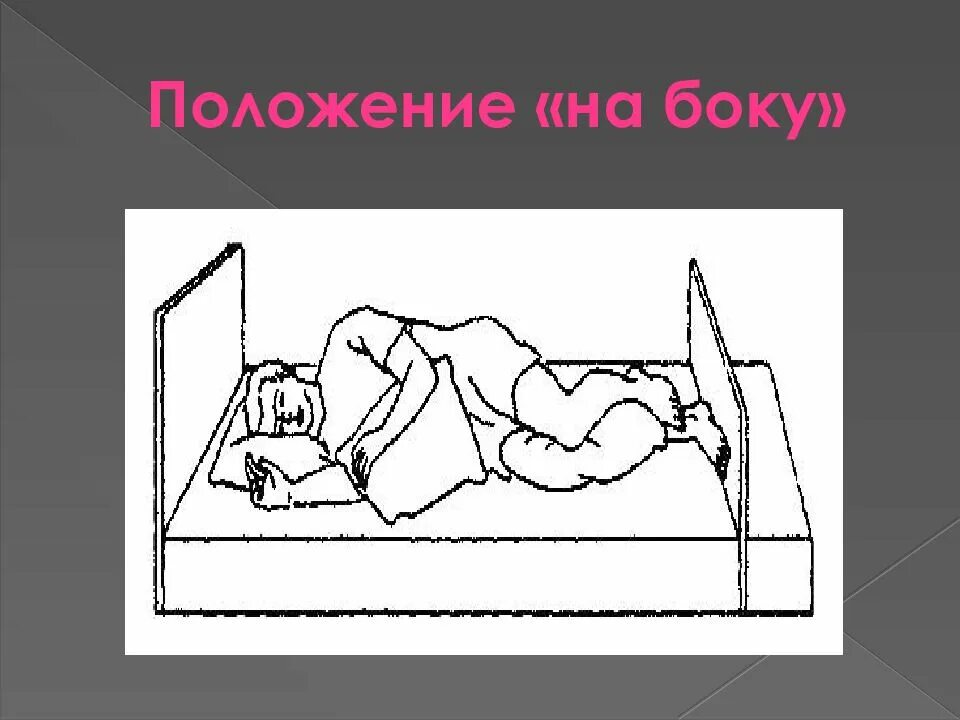 Размещение пациента на боку. Размещение пациента лежа на боку. Размещение пациента в положение лежа на боку. Положение на боку пациента в постели. В зависимости от того какой лежит