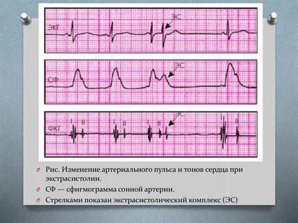 Тон пульс