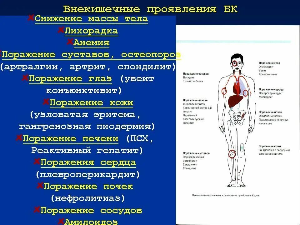 Функциональные заболевания кишечника. Функциональные и органические заболевания. функциональные и органические заболевания кишечника у детей. функциональные заболевания кишечника классификация.