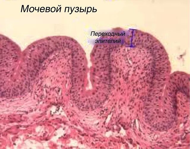 Слои переходного эпителия. Многослойный переходный эпителий мочевого пузыря. Уротелий мочевого пузыря гистология. Переходный эпителий мочевого пузыря кролика. Эпителий мочевого пузыря гистология.