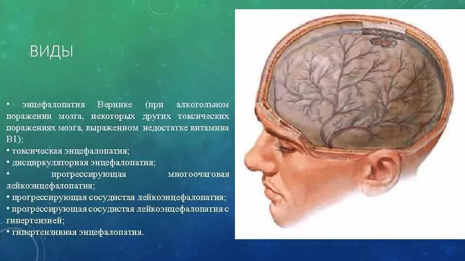 Резидуальное поражение головного. Энцефалопатия головного мозга что это такое. Органическое поражение головного мозга. Алкогольная энцелофапатия головного мозга что это такое. Токсическое поражение головного мозга.