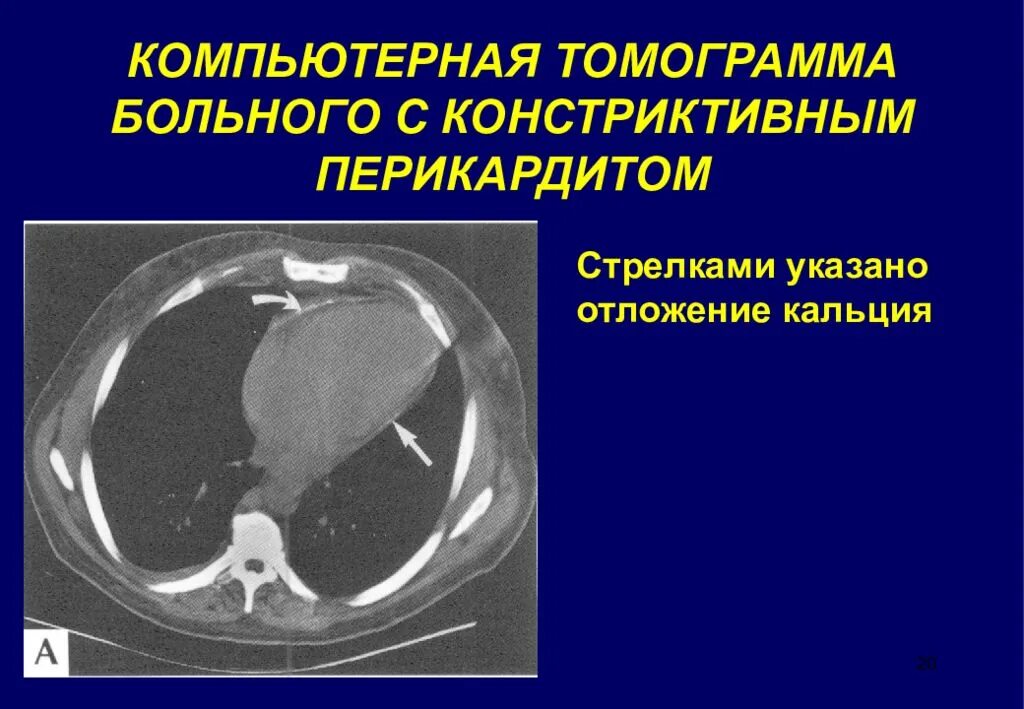 Болит кт