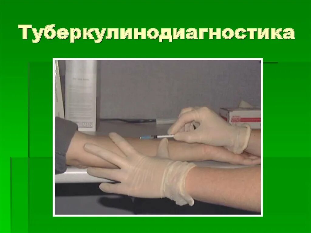 Проведение пробы диаскинтест