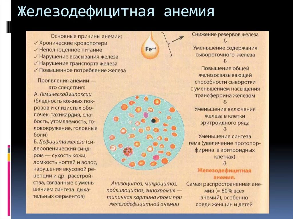 Почему низкое железо в крови. Железо крови при железодефицитной анемии. Алиментарная анемия симптомы. Симтомы Анимия железодефицитная анемия. Железо-дифецитная Анимия.