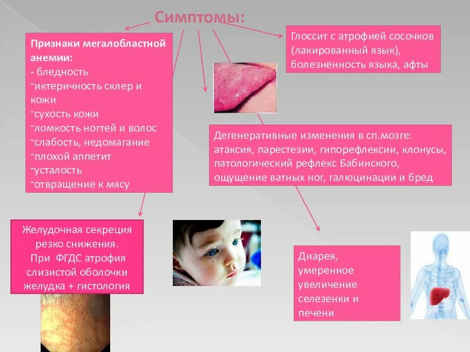 Признаки дефицитной анемии. Сисптомы анемии у ребёнка. Железодефицитная анемия у детей симптомы.