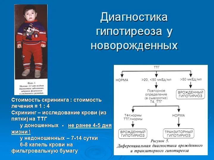 Неонатальный скрининг гипотиреоза. Скрининг на врожденный гипотиреоз. Неонатальный скрининг на врожденный гипотиреоз. Диагностика гипотиреоза у новорожденных. Неонатальный скрининг ТТГ норма.