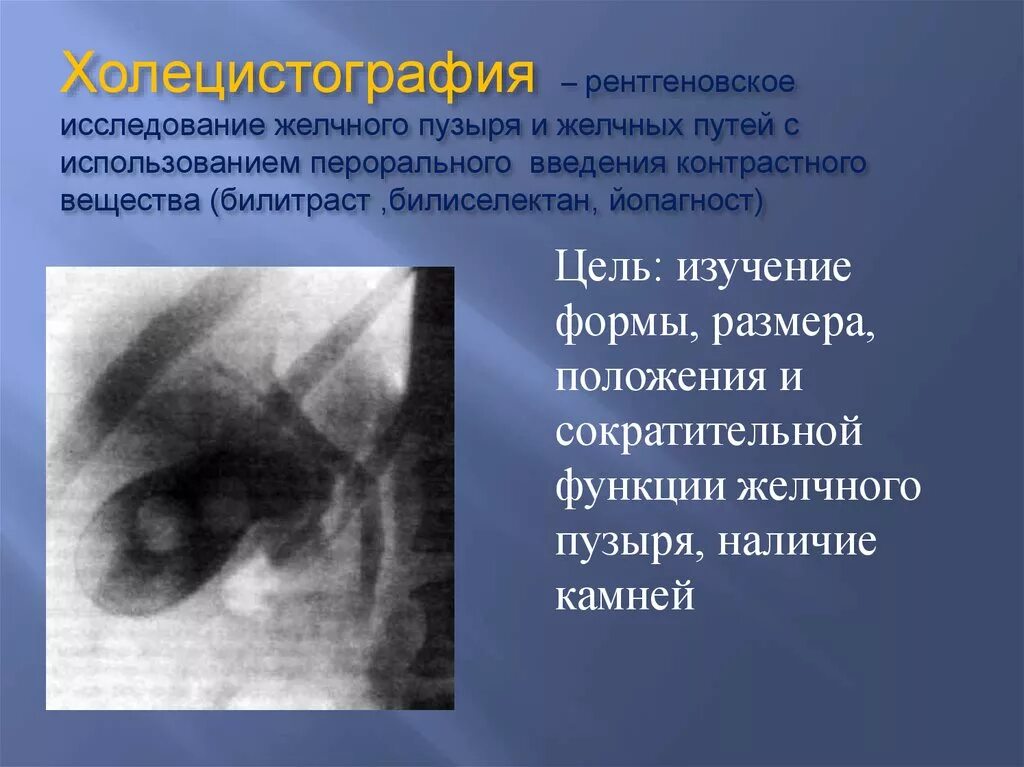 Пероральная холецистография. Рентгенологические методы исследования желчного пузыря. Рентгенологический метод исследования желчного пузыря. Холецистография метод исследования. Экскреторная холецистография.