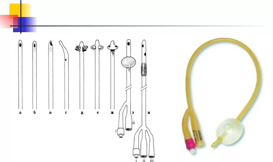 Катетер для беременных. Катетер расширитель 18f. Катетер Фолея диаметр трубки 22. Катетер 13 g 2,4х8. Unicorn катетер Фолея ch12 5-15мл.