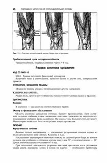 Растяжение сухожилия четырехглавой мышцы