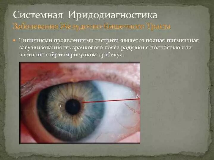 Радужную оболочку глаз как персональные данные. Радужную оболочку глаз как персональные данные