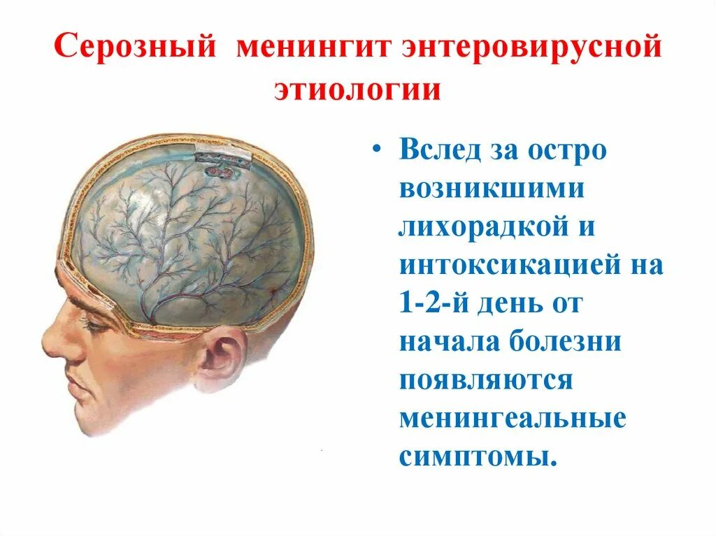 Оболочка головного мозга менингит. Менингит воспаление оболочек головного мозга. Воспаление головного мозга симптомы менингит. Серозный менингит. Поражение оболочек мозга