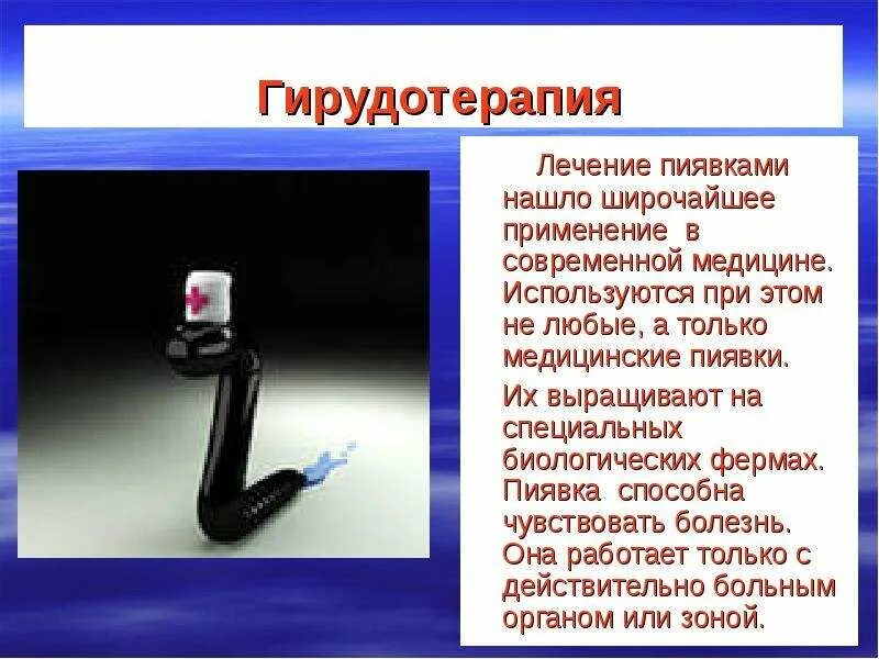 Показания для постановки пиявок. Гирудотерапия применение в медицине. От каких болезней пиявки