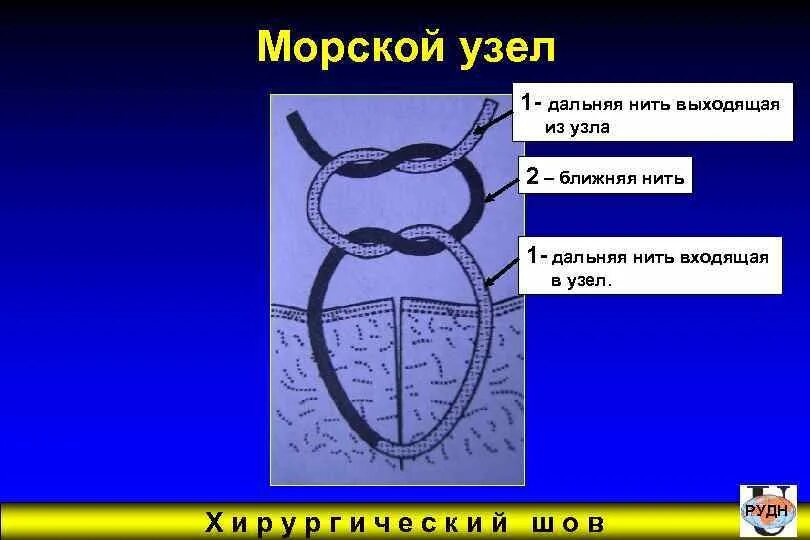 Как завязывать медицинский узел Зарница "Школа безопасности"