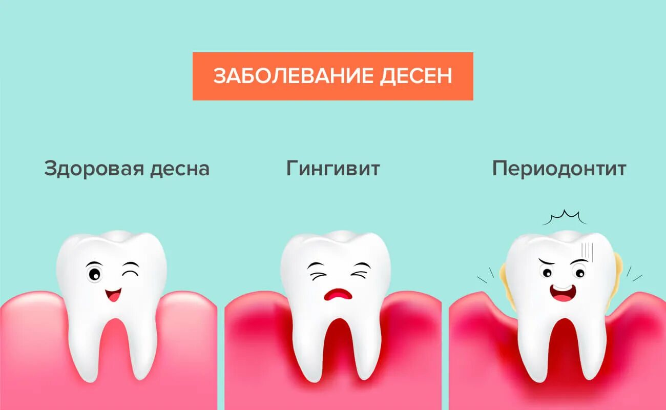 Скажи зуб. Здоровый и больной зуб. Здоровый зуб и больной зуб. Больные зубы картинки для детей.