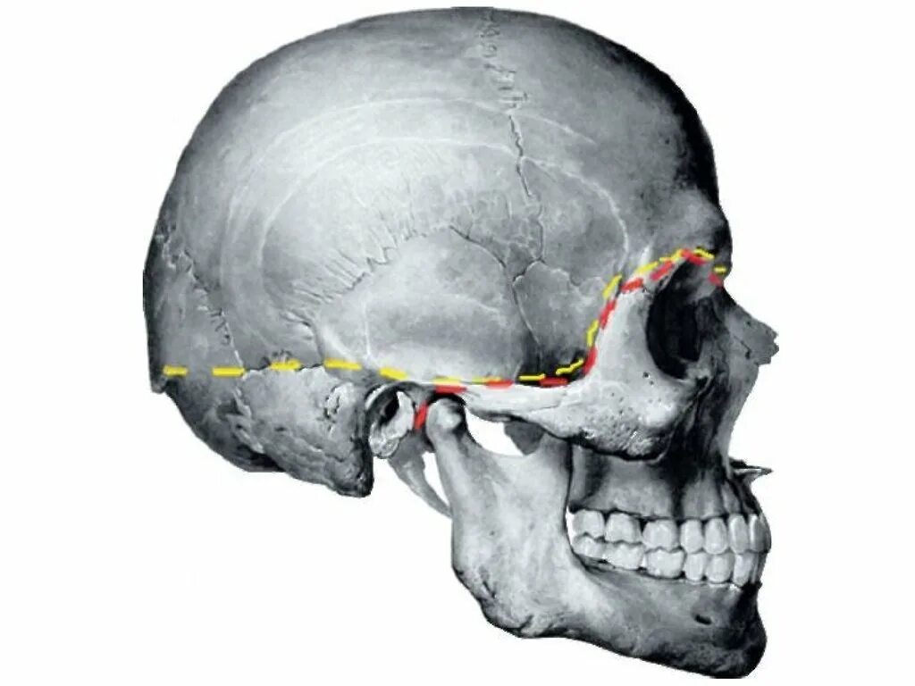 Граница мозгового и лицевого отделов черепа. Граница между мозговым и лицевым отделом черепа. Граница между сводом и основанием черепа. Свод и основание черепа.