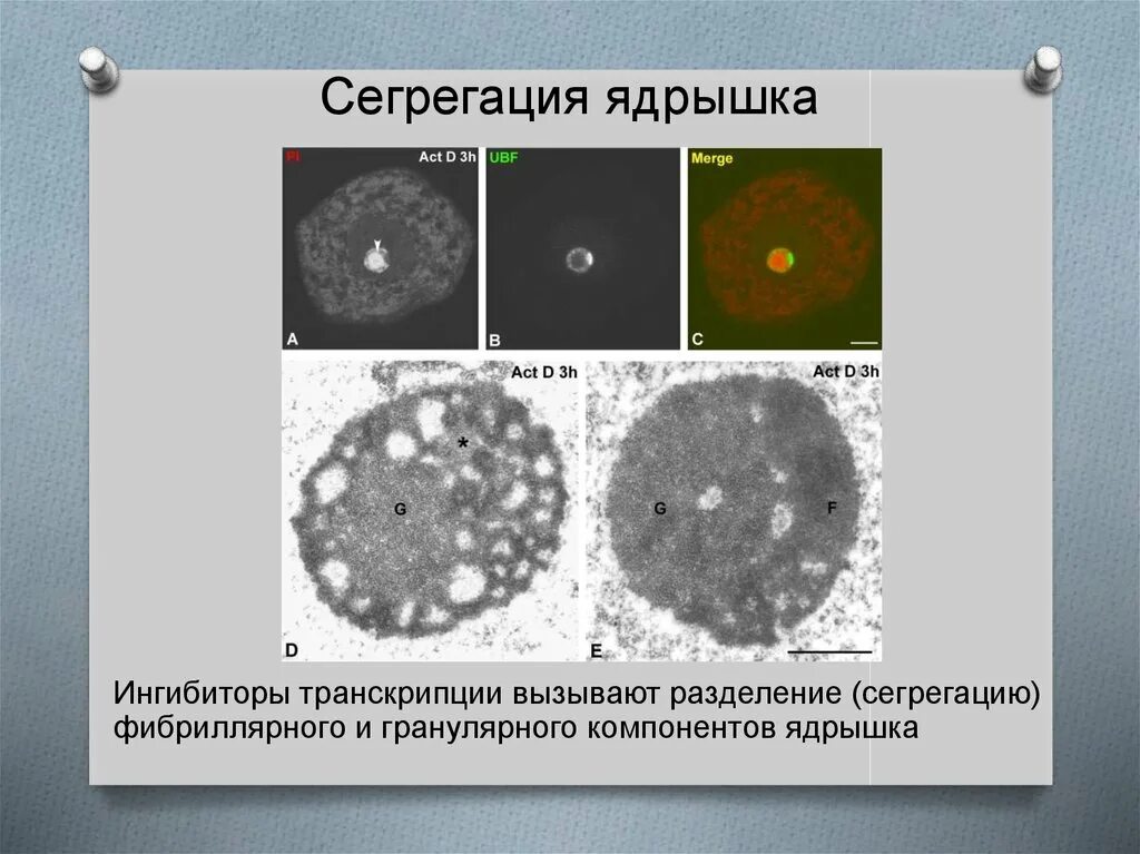 Растворение ядрышка. Сегрегация ядрышек. Образование ядрышка. Сегрегация химических элементов это. Фибриллярный и гранулярный компонент ядрышка.