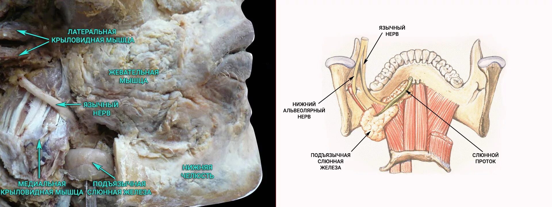 Нижний альвеолярный и язычный нерв. Анатомия нижней челюсти нерв. Альвеолярный нерв нижней челюсти. Альвеолярный нерв нижней челюсти повреждение симптомы.