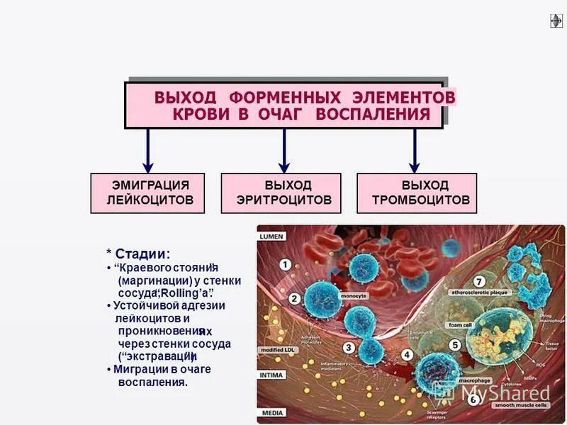 стадии и механизмы эмиграции лейкоцитов. стадии миграции лейкоцитов в очаг воспаления схема. механизмы эмиграции лейкоцитов в очаг воспаления. механизм эмиграции лейкоцитов при воспалении. механизмы эмиграции лейкоцитов в очаг воспаления.