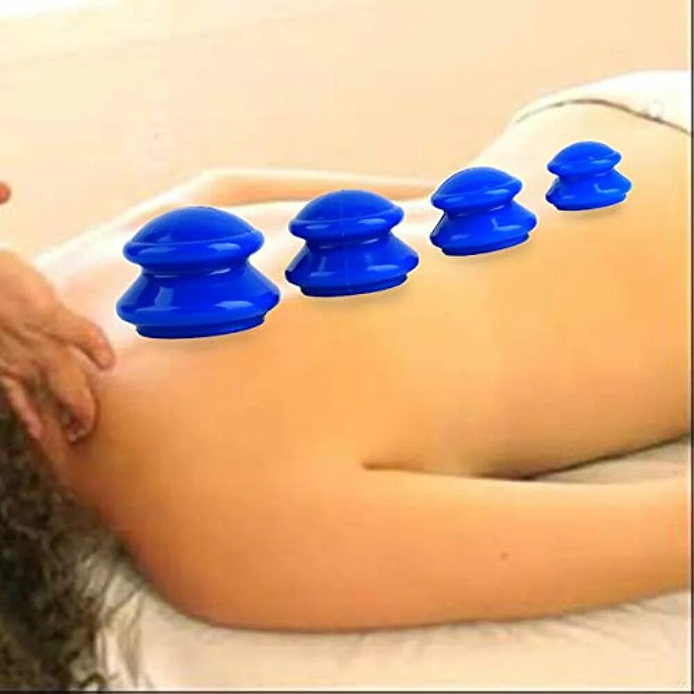 Вакуумный массаж. Резиновые банки для массажа на спине. Вакуумные банки для массажа спины.