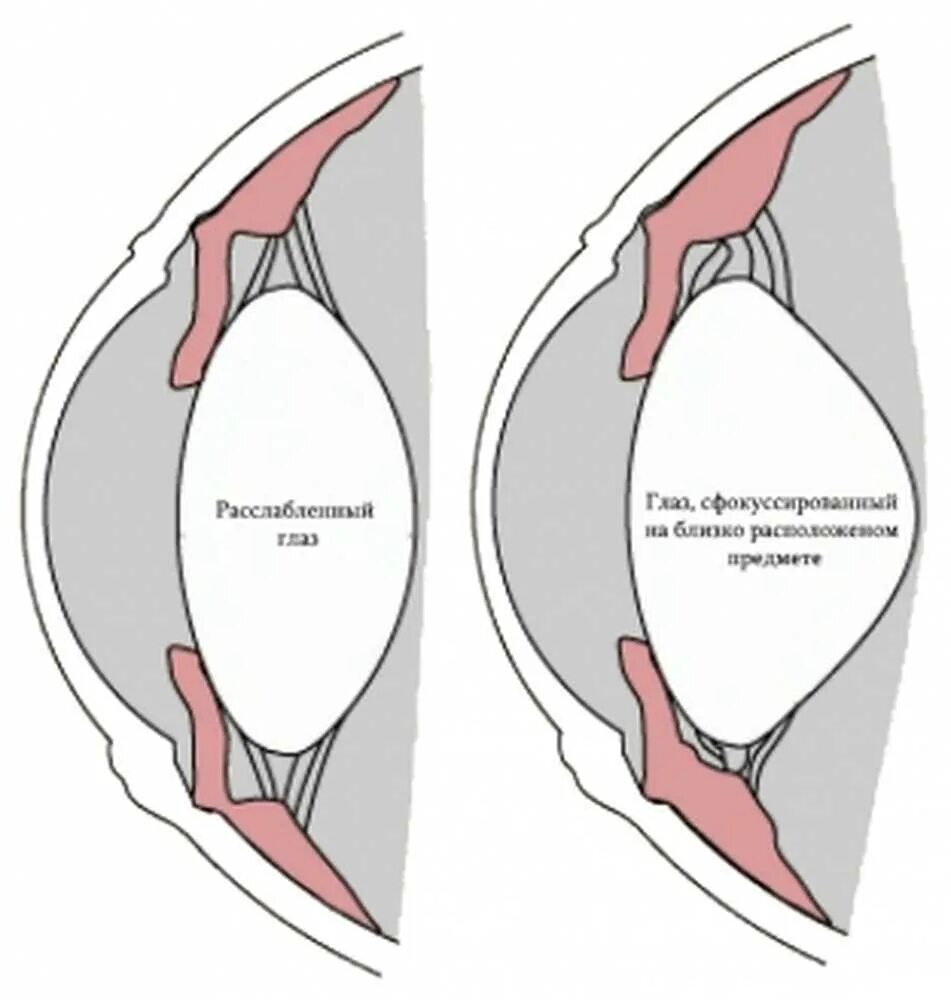 Снятие спазма аккомодации. Спазм аккомодации глаз. Аккомодация спазм аккомодации. Спазм аккомодации мышцы. Цилиарная мышца глаза спазм аккомодации.