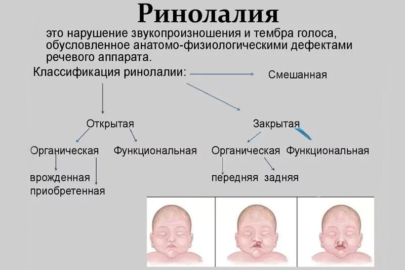 Ринолалия. Ринолалия это нарушение. Ринолалия классификация. Органическая ринолалия.