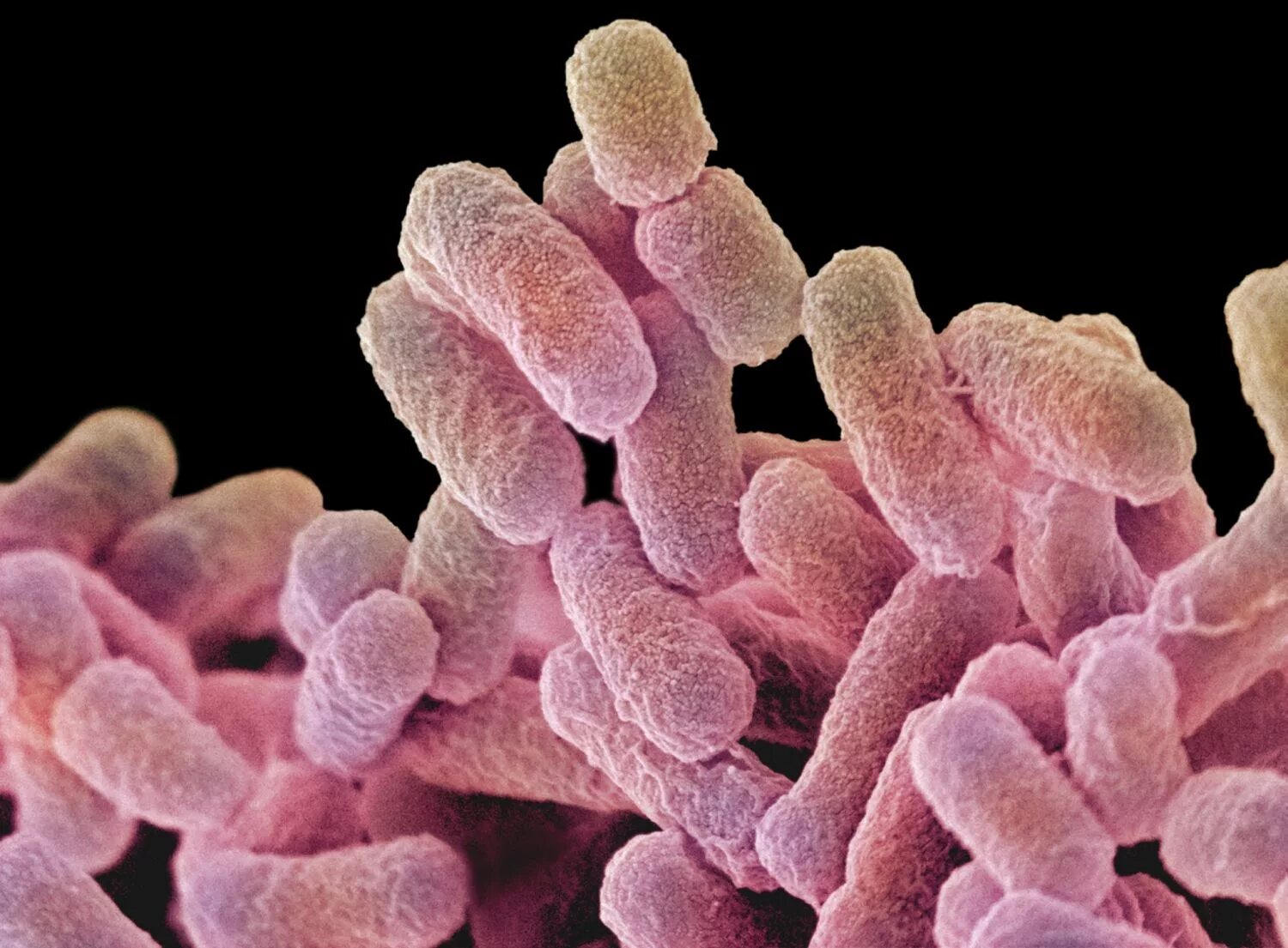 Сальмонелла (Salmonella). Сальмонелла Анатум. Сальмонеллой schottmuelleri. Сальмонелла холерасуис. Сальмонеллез бактерия