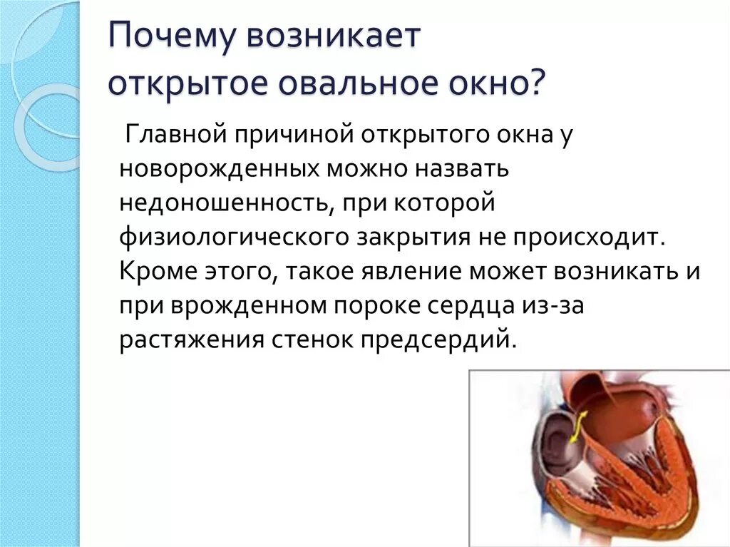 Окно в сердце у новорожденного. Открытое овальное окно у плода. причины открытого овального окна. открытое овальное окно у новорожденных. почему у детей открытое овальное окно.