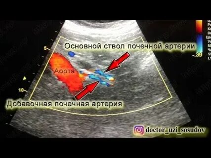 2 артерии в почках