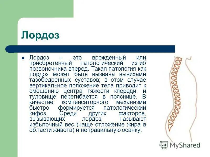 кифоз поясничного отдела позвоночника. гиперлордоз шейного отдела позвоночника. лордоз шейного отдела позвоночника. лордоз крестцового отдела позвоночника. строение позвоночника лордоз кифоз.