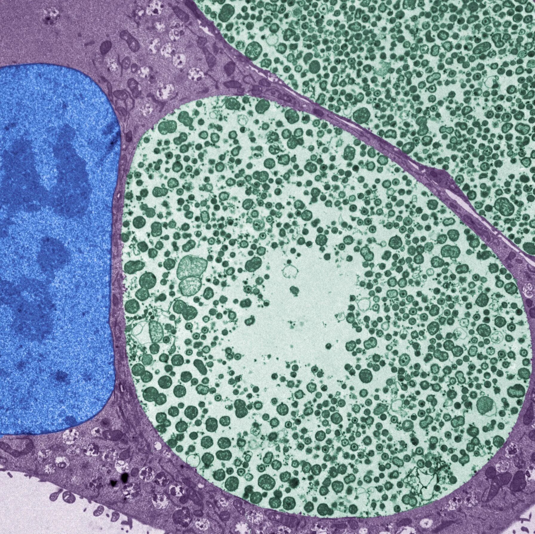 Хламидия трахоматис микроскопия. Хламидия пневмония под микроскопом. Хламидиоз микроскопия.