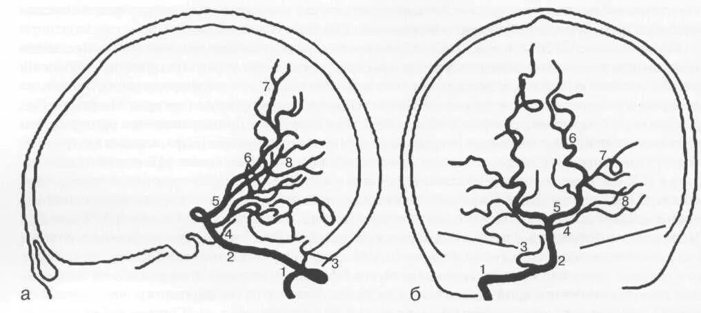 Интракраниальные артерии головного мозга. Интракраниальные артерии кт. Ангиографическая анатомия церебральных сосудов. Экстракраниальные и интракраниальные сосуды. Интракраниальные артерии головного.
