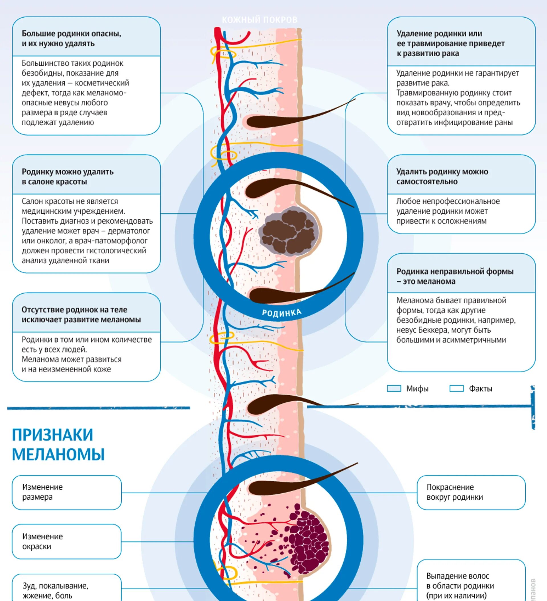 Меланома кожи памятка для пациентов. Распространенность новообразований кожи меланомы в мире. Схема перерождения меланомы.