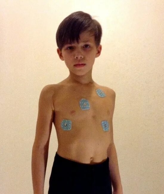 холтеровское мониторирование у детей. холтер. холтеровское мониторирование у детей. холтеровское мониторирование у детей. холтер ребенку.