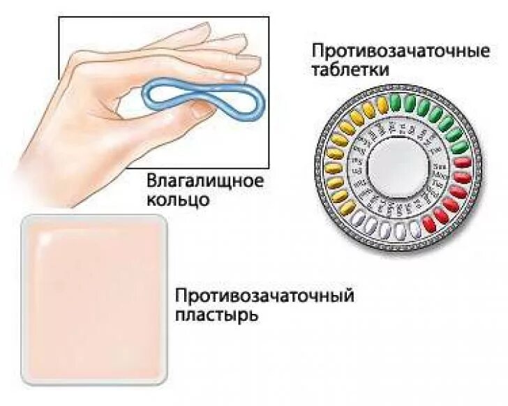 Противозачаточные после месяца. Гормональные контрацептивы кольцо новаринг. Гормональные контрацептивы влагалищное кольцо. Гормональная контрацепция пластырь таблетки кольцо. Кольцо метод контрацептива.