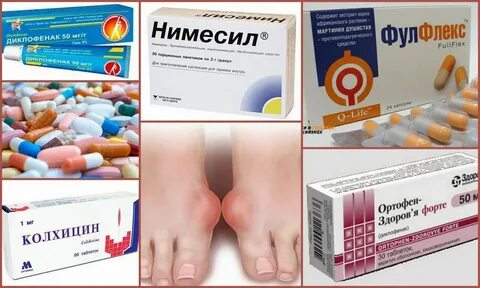 Какие таблетки при подагре ног