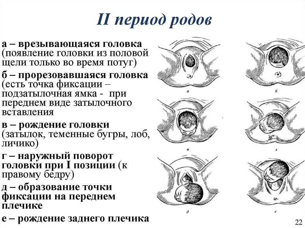 Признаки роды день родов. Фазы второго периода родов. Врезывание и прорезывание головки. Периоды родов Длительность родов.