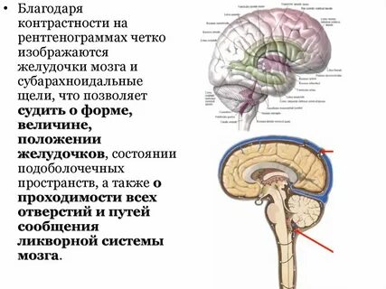 Умеренно расширенные ликворные пространства