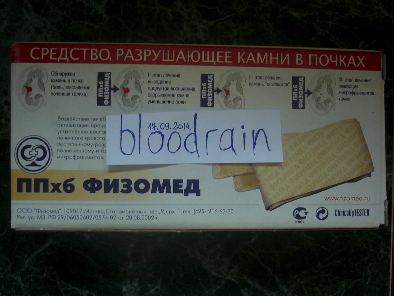 Пояс от камней в почках Физомед. ППХБ Физомед. Лечебный пояс Физомед. Парафиновый пояс Физомед.