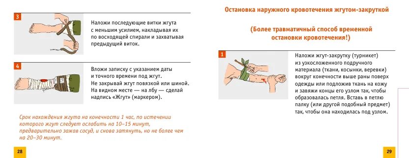 Жгут следует применять при кровотечении. Схема наложения жгута при артериальном кровотечении. способы остановки наружного кровотечения жгутом. артериальное кровотечение жгут. наложение жгута для остановки артериального кровотечения.