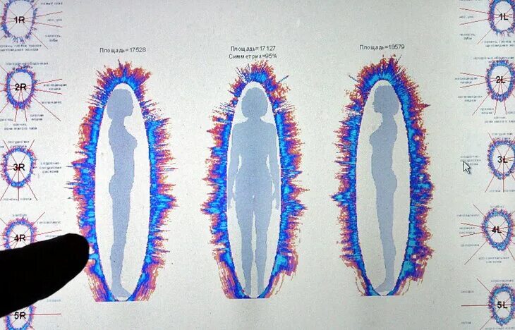 Аура человека. Биополе человека. Биополе человека Аура. Энергетическое поле человека.