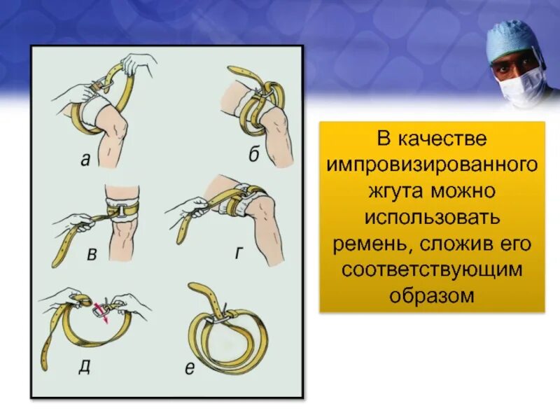 Что можно использовать в качестве жгута. Наложение импровизированного жгута. импровизированные жгуты. что можно использовать в качестве кровоостанавливающего жгута.
