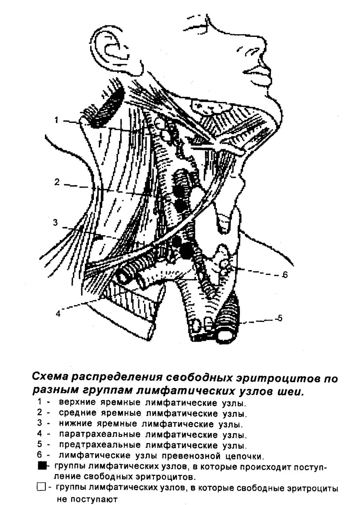 Нижнечелюстной лимфоузел. Нижние яремные лимфоузлы. Верхние яремные лимфоузлы. Шейный верхний ярёмный лимфоузел. Задние нижние шейные лимфатические узлы.