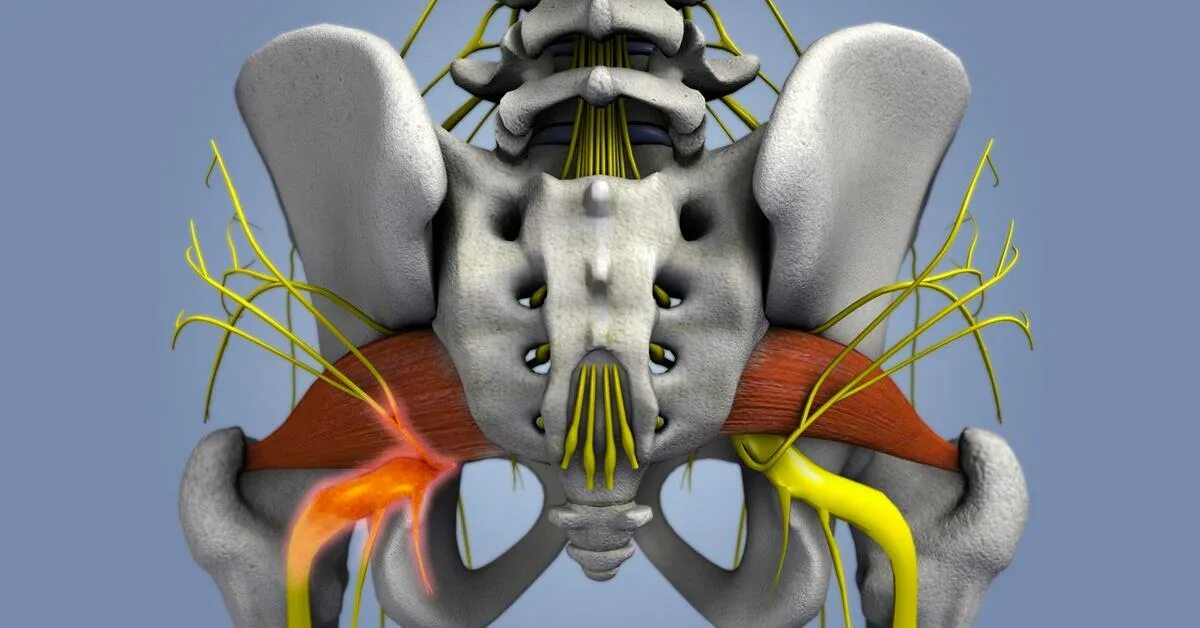 Седалищный отдела позвоночника. Ишиас и синдром грушевидной мышцы. Седалищный нерв грушевидная анатомия. Иннервация седалищного нерва анатомия. Иннервация тазобедренного сустава.