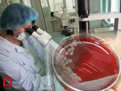 Сибирская язва лабораторные исследования