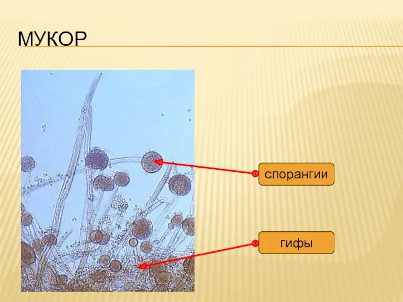 Признаки мукора. Спорангии мукора. Мукор колонка. Строение спорангия мукора. Мукор на Сабуро.