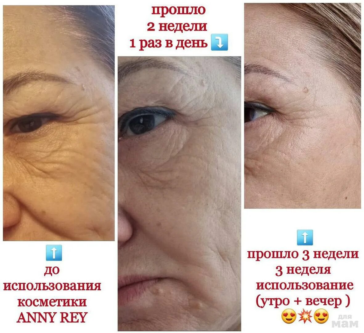 Лифтинг-программы. Anny Rey Lift Impact. Программа омоложения. Any ray косметика.